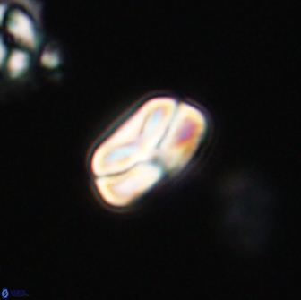 Heliolithus nefroeidis 66603