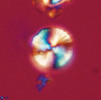 Heliolithus nefroeidis 66614