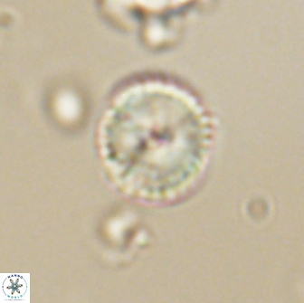 Heliolithus nefroeidis 66616