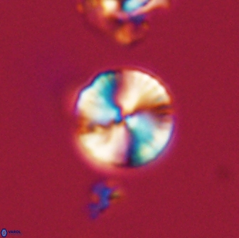 Heliolithus nefroeidis 66610