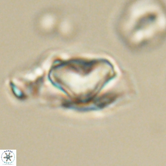 Heliolithus nefroeidis 66695