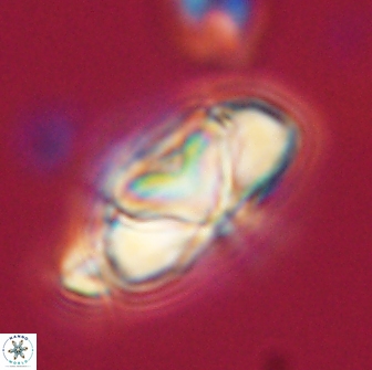 Heliolithus nefroeidis 66692