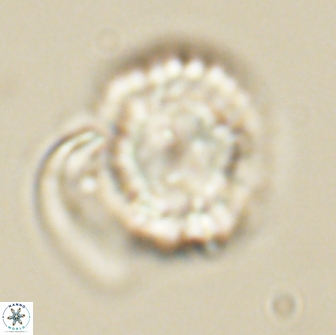 Heliolithus nefroeidis 66707