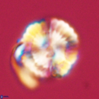 Heliolithus nefroeidis 66709