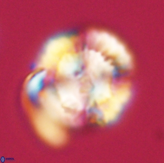 Heliolithus nefroeidis 66714