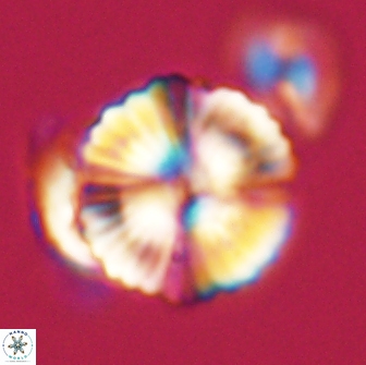 Heliolithus nefroeidis 66715