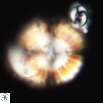 Heliolithus nefroeidis 66719