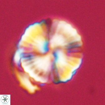 Heliolithus nefroeidis 66710