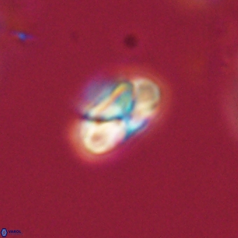 Heliolithus nefroeidis 69345