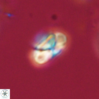 Heliolithus nefroeidis 69345