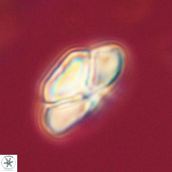 Heliolithus nefroeidis 69547