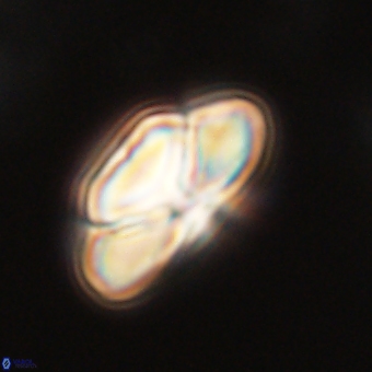 Heliolithus nefroeidis 69548