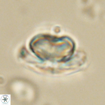Heliolithus nefroeidis 69554