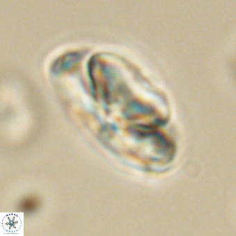 Heliolithus nefroeidis 69553