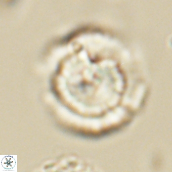 Heliolithus nefroeidis 69564