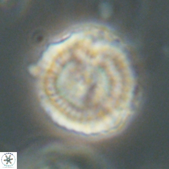 Heliolithus nefroeidis 69561