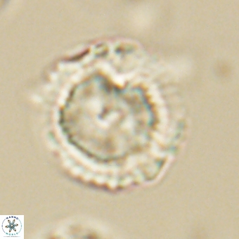 Heliolithus nefroeidis 69562