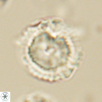 Heliolithus nefroeidis 69563