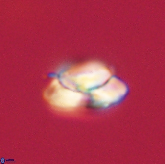 Heliolithus nefroeidis 61688