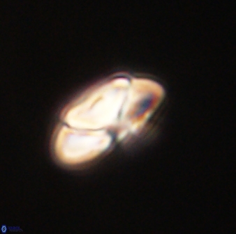 Heliolithus nefroeidis 61698