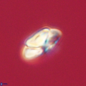 Heliolithus nefroeidis 61699