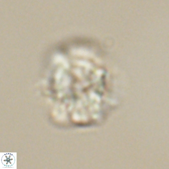 Heliolithus nefroeidis 61704