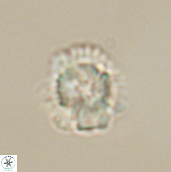 Heliolithus nefroeidis 61705