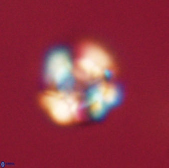 Heliolithus nefroeidis 61703