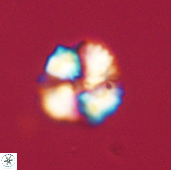 Heliolithus nefroeidis 61710