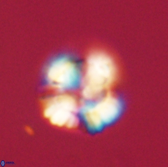 Heliolithus nefroeidis 61712