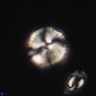 Heliolithus nefroeidis 61864