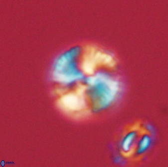 Heliolithus nefroeidis 61865