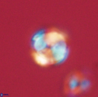 Heliolithus nefroeidis 61866