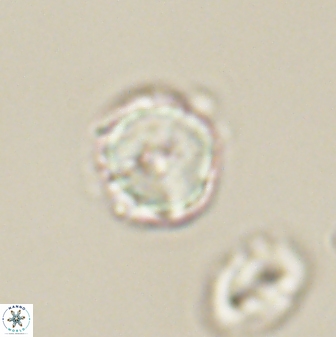 Heliolithus nefroeidis 61868