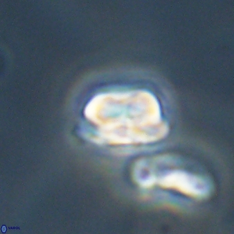 Heliolithus nefroeidis 61875