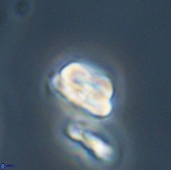 Heliolithus nefroeidis 61877