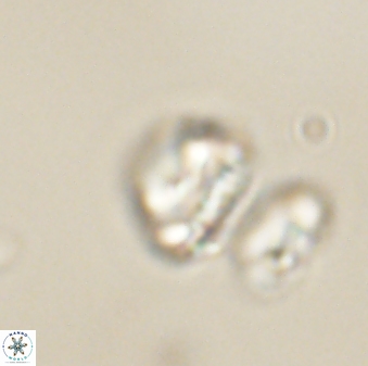 Heliolithus nefroeidis 61879