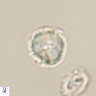 Heliolithus nefroeidis 61870