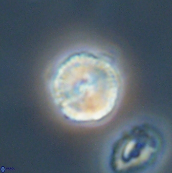 Heliolithus nefroeidis 61871