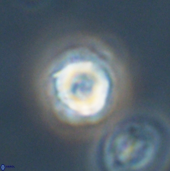 Heliolithus nefroeidis 61872