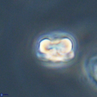 Heliolithus nefroeidis 61873