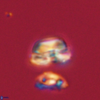 Heliolithus nefroeidis 61890