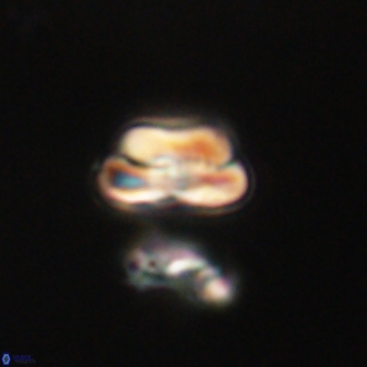 Heliolithus nefroeidis 61892