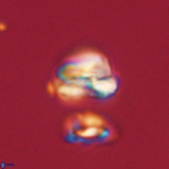 Heliolithus nefroeidis 61907