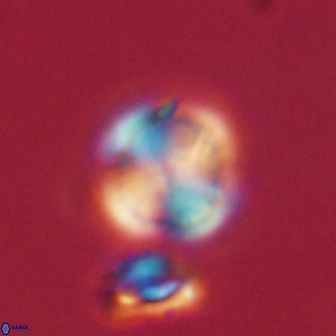 Heliolithus nefroeidis 61914