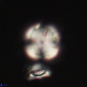 Heliolithus nefroeidis 61911