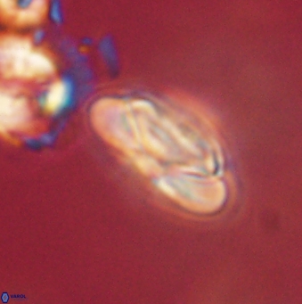 Heliolithus nefroeidis 62065