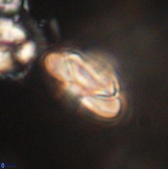 Heliolithus nefroeidis 62066