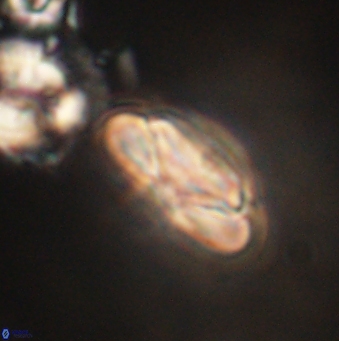 Heliolithus nefroeidis 62067