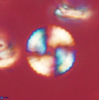 Heliolithus nefroeidis 62069